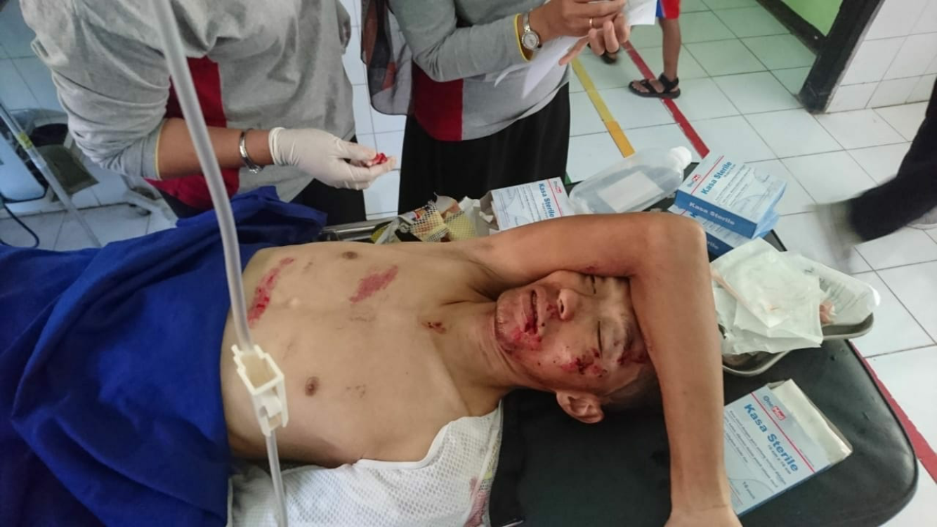 Kecelakaan, PB ISSI Tak Rekom Atlet Berlatih Ditanjakan Emen Tanpa Pengawalan