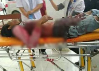 Pekerja Bangunan Diserang OTK di Wamena