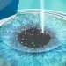 Ketergantungan Kacamata Minus? Saatnya Coba LASIK